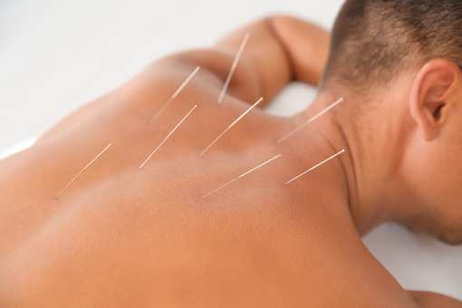 10 Best Acupuncture Clinics in Arizona!