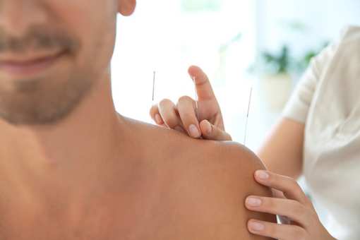 10 Best Acupuncture Clinics in California!
