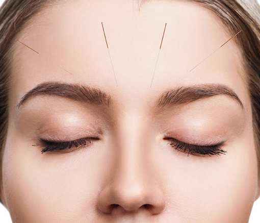 10 Best Acupuncture Clinics in Idaho!
