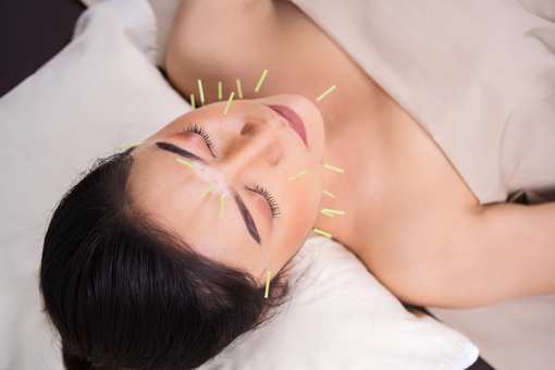 10 Best Acupuncture Clinics in Indiana!