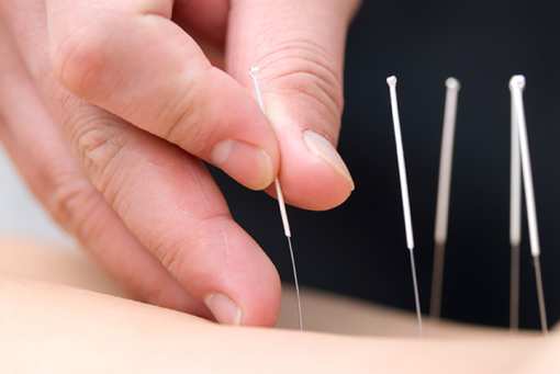 10 Best Acupuncture Clinics in Minnesota!