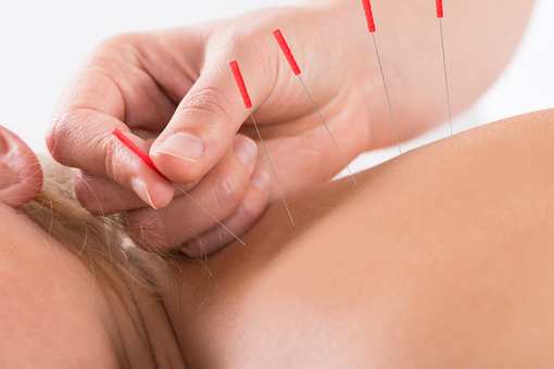 10 Best Acupuncture Clinics in New Jersey!
