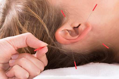 9 Best Acupuncture Clinics in New Mexico!