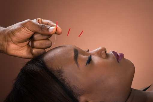 10 Best Acupuncture Clinics in New York!