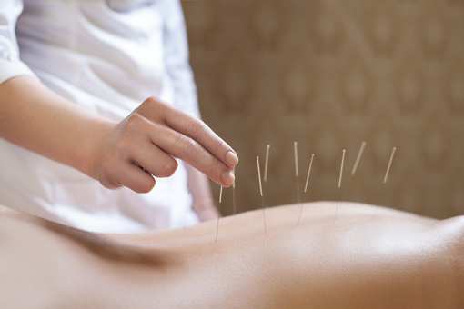 10 Best Acupuncture Clinics in Ohio!