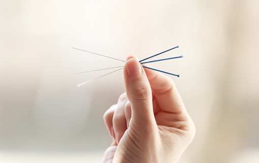 10 Best Acupuncture Clinics in Virginia!
